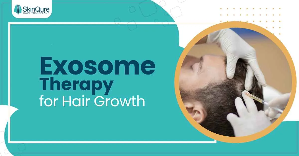 Exosome therapy for hair growth - scalp treatment by a dermatologist at SkinQure, Delhi